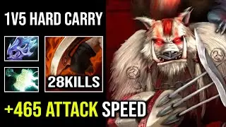 WTF +465 Attack Speed Bloodseeker Brutal Ultrasonic 1v5 Unstoppable Hard Carry Dota 2