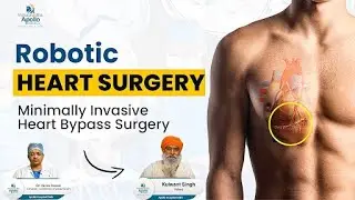 Robotic Heart Bypass Surgery: A Life Saving Robotic Surgery At Apollo Hospitals Delhi