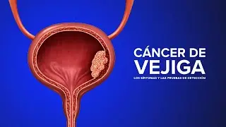 Cáncer de Vejiga - Los síntomas y las pruebas de detección