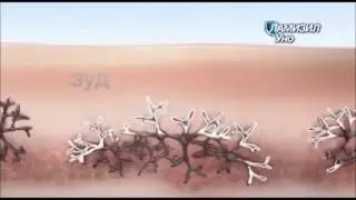 Реклама Ламизил Уно - "Лечение грибка стопы за одно применение"