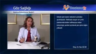 Retina Dekolmanı Nedir?