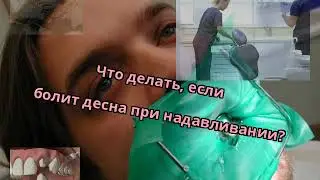 Что делать, если болит десна при надавливании?