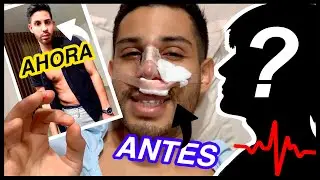 Me operé la NARIZ 👃/ RINOPLASTIA 🏥(primeros 7 DÍAS )🔥Guatemala 🇬🇹PABLOGGERO