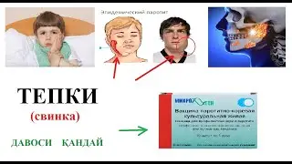 ТЕПКИ КАСАЛЛИГИ свинка ХАКИДА КИСКАЧА,,,,