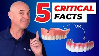 Hidden Costs of Dental Implants and Dentures Exposed