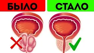 Простатит исчез быстро! Выбери один из этих 7+ рецептов, и забудешь про простатит
