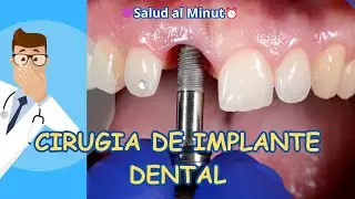 DESCUBRE COMO ES LA CIRUGIA DE IMPLANTE DENTAL