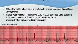 NCLEX Tutor: EKG strips for the NCLEX & beginners