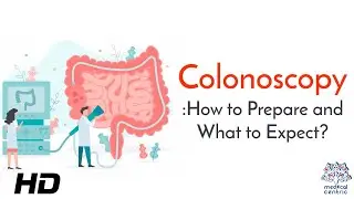 Colonoscopy: The Lifesaving Procedure You Shouldn't Ignore