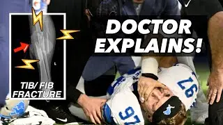 Scariest NFL Injury? Doctor explains Aidan Hutchinson leg injury 