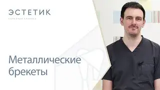 ⛓ Металлические брекеты