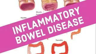 Inflammatory Bowel Disease - pathology | The White Army