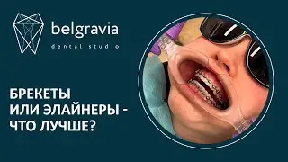 ➡ Брекеты или элайнеры - что лучше?