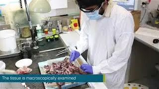 Training | Anatomical pathology processing of mesothelioma