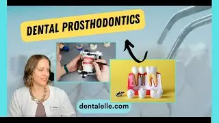 Dental Prosthodontics - Crowns, Bridges, Dentures, Implants...