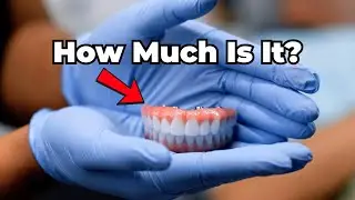 Full Mouth Dental Implant Cost in 2025