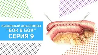 Серия 9. Кишечный анастомоз бок в бок