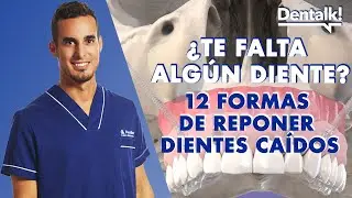 Así se REPONEN los DIENTES perdidos o faltantes | Dentalk! © | Dentalk! ©