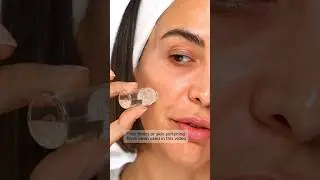 Skin AFTER at-home Microneedling | NO FILTER