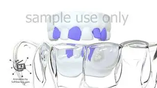 about teeth 3d medical animation|sample use only|Dandelion team