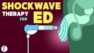 Shockwave therapy for Erectile Dysfunction | Erectile Dysfunction Treatment | ED | ED Treatment