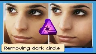 Removing Dark Circles in Affinity Photo