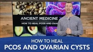 How to Treat PCOS and Ovarian Cysts Naturally | Dr. Josh Axe