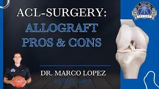 ACL R Allograft Pros & Cons