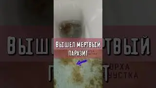 Вышел мертвый паразит  #здоровье #гельмиты #кишечник