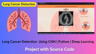 Lung Cancer Detection Using CNN Project with Source Code | Python | Tensorflow