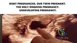 RISKY PREGNANCIES. OUR TWIN PREGNANT. THE ONLY ONGOING PREGNANCY.  UNDEVELOPING PREGNANCY.