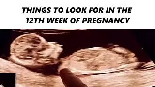 THINGS TO LOOK FOR IN THE   12TH WEEK OF PREGNANCY#ultrasound #pregnancyscan #pregnancytest