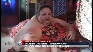 Potret Wanita Obesitas 350 Kg di Palangkaraya, Hanya Mampu Terbaring - BIM 07/01