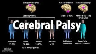 Cerebral Palsy, Animation