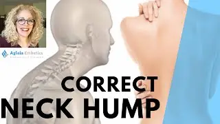 HOW TO GET RID OF A NECK HUMP  (STRENGHTEN NECK MUSCLES)