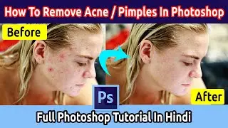 How to remove pimples, Acne in photoshop tutorial in hindi