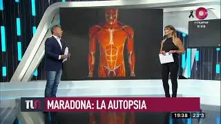 Se conoció el resultado preliminar de la autopsia de Maradona