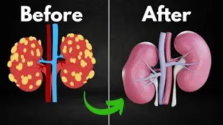 Magical Fruits For Kidneys Health || Detox Your Kidneys