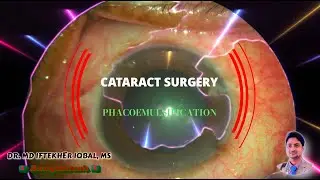 MIIQ 110: Cataract Surgery ছানি অপারেশন | Phaco with @SonyXperia 1V | DR. MD IFTEKHER IQBAL RAJU