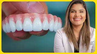 How Dental Implants Actually Work | Are They A Fix All?