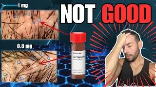 Verteporfin Potential Hair Loss Cure - UPDATE