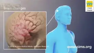 Magnetic Resonance Imaging MRI - CIMS Hospital