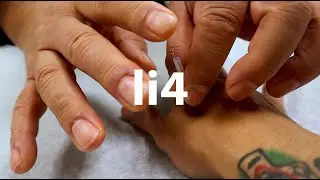 Li-4 & proper hand position | hemiplegia [acupuncture | medicine | dongguk university los angeles]