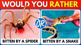 Would You Rather...? 150 HARDEST Choices Ever! 😱😲🤯