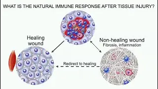 The Immune System in Regenerative Medicine