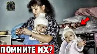 35 лет спустя: Что СТАЛО с СИАМСКИМИ близнецами Вилией и Виталией?