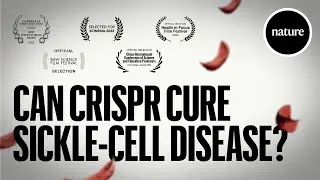 Can CRISPR cure Sickle-cell Disease?