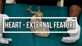 Heart - external feature