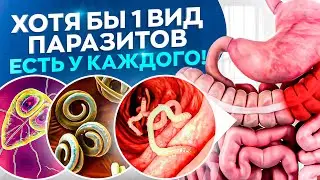 5 самых распространенных видов паразитов, которые живут в теле человека