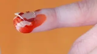 FINGERNAIL COMES OFF!